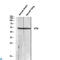 Vitronectin antibody, LS-C813537, Lifespan Biosciences, Western Blot image 