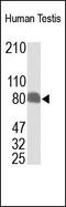 P21 (RAC1) Activated Kinase 6 antibody, 251927, Abbiotec, Western Blot image 