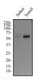 IKAROS Family Zinc Finger 3 antibody, NBP2-24495, Novus Biologicals, Western Blot image 