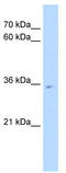 POU Class 6 Homeobox 1 antibody, TA342420, Origene, Western Blot image 