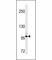 Discoidin Domain Receptor Tyrosine Kinase 2 antibody, F53649-0.1ML, NSJ Bioreagents, Western Blot image 