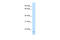 Family With Sequence Similarity 107 Member A antibody, 29-740, ProSci, Western Blot image 