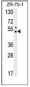 Pseudouridine Synthase 3 antibody, AP53522PU-N, Origene, Western Blot image 