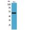 Nuclear Receptor Subfamily 1 Group H Member 3 antibody, LS-C386903, Lifespan Biosciences, Western Blot image 