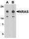 Ras antibody, PA5-34560, Invitrogen Antibodies, Western Blot image 