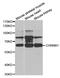 Cholinergic Receptor Nicotinic Beta 1 Subunit antibody, abx004045, Abbexa, Western Blot image 