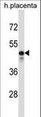 Potassium Voltage-Gated Channel Modifier Subfamily S Member 2 antibody, LS-C165449, Lifespan Biosciences, Western Blot image 