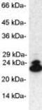 Proteasome Subunit Beta 9 antibody, ab3328, Abcam, Western Blot image 