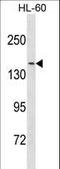 Nuclear Receptor Coactivator 3 antibody, LS-C157991, Lifespan Biosciences, Western Blot image 