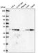 Growth Differentiation Factor 11 antibody, HPA069609, Atlas Antibodies, Western Blot image 