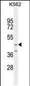 Otoconin 90 antibody, PA5-71564, Invitrogen Antibodies, Western Blot image 