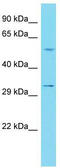 Immunoglobulin Like Domain Containing Receptor 2 antibody, TA337354, Origene, Western Blot image 