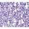 TBC1 Domain Family Member 10C antibody, LS-C34717, Lifespan Biosciences, Immunohistochemistry paraffin image 