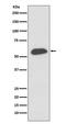 Interferon Regulatory Factor 5 antibody, M00958, Boster Biological Technology, Western Blot image 