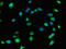 Collagen Type VIII Alpha 1 Chain antibody, orb23334, Biorbyt, Immunofluorescence image 