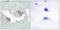 Platelet Derived Growth Factor Receptor Alpha antibody, P30446, Boster Biological Technology, Immunohistochemistry frozen image 