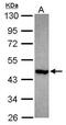 PNMA Family Member 2 antibody, PA5-30982, Invitrogen Antibodies, Western Blot image 