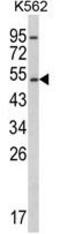 Cytochrome P450 Family 2 Subfamily E Member 1 antibody, GTX81120, GeneTex, Western Blot image 