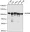 Nucleoporin 98 antibody, 13-195, ProSci, Western Blot image 