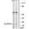 Claudin 19 antibody, A08096, Boster Biological Technology, Western Blot image 