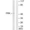 Fyn Related Src Family Tyrosine Kinase antibody, A04075, Boster Biological Technology, Western Blot image 