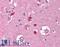 Flap Structure-Specific Endonuclease 1 antibody, LS-B1694, Lifespan Biosciences, Immunohistochemistry frozen image 