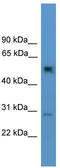 Protein Phosphatase 2 Regulatory Subunit Bgamma antibody, TA344602, Origene, Western Blot image 
