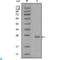 AXL Receptor Tyrosine Kinase antibody, LS-C812401, Lifespan Biosciences, Western Blot image 