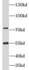 Neuregulin 1 antibody, FNab05856, FineTest, Western Blot image 