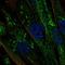 Cytochrome P450 19A1 antibody, HPA051194, Atlas Antibodies, Immunofluorescence image 