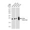 Ferritin Heavy Chain 1 antibody, GTX00928, GeneTex, Western Blot image 