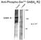 Gamma-Aminobutyric Acid Type B Receptor Subunit 2 antibody, GTX31019, GeneTex, Western Blot image 