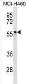 Phosphorylated adapter RNA export protein antibody, LS-C163560, Lifespan Biosciences, Western Blot image 