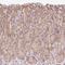 Transmembrane Protein 170B antibody, HPA055134, Atlas Antibodies, Immunohistochemistry paraffin image 