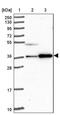 Coiled-Coil Domain Containing 137 antibody, PA5-62871, Invitrogen Antibodies, Western Blot image 