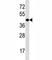 NK2 Homeobox 5 antibody, F45607-0.4ML, NSJ Bioreagents, Western Blot image 