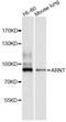 Aryl Hydrocarbon Receptor Nuclear Translocator antibody, STJ22685, St John