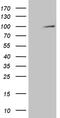 Glycogen Phosphorylase, Muscle Associated antibody, MA5-27445, Invitrogen Antibodies, Western Blot image 