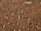 Cytochrome B-245 Beta Chain antibody, LS-C406620, Lifespan Biosciences, Immunohistochemistry frozen image 