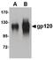 Inter-Alpha-Trypsin Inhibitor Heavy Chain 4 antibody, PA5-20584, Invitrogen Antibodies, Western Blot image 