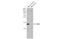 Cytochrome C Oxidase Subunit 4I1 antibody, GTX628901, GeneTex, Western Blot image 