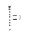 Hepatitis A Virus Cellular Receptor 2 antibody, A00657-1, Boster Biological Technology, Western Blot image 