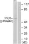 Eukaryotic Translation Initiation Factor 2 Alpha Kinase 2 antibody, LS-C117460, Lifespan Biosciences, Western Blot image 