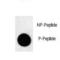 Microtubule Associated Protein 1 Light Chain 3 Beta antibody, LS-C163593, Lifespan Biosciences, Dot Blot image 