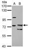 Forkhead Box P4 antibody, LS-C155484, Lifespan Biosciences, Western Blot image 