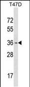 Orthodenticle Homeobox 1 antibody, PA5-48716, Invitrogen Antibodies, Western Blot image 