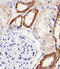 Sorting Nexin 3 antibody, A05169-2, Boster Biological Technology, Immunohistochemistry paraffin image 