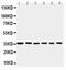 PDZ Binding Kinase antibody, PA5-79785, Invitrogen Antibodies, Western Blot image 