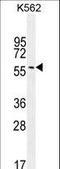 Eukaryotic Translation Initiation Factor 2B Subunit Delta antibody, LS-C167683, Lifespan Biosciences, Western Blot image 