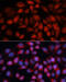 Acyl-CoA Dehydrogenase Medium Chain antibody, 18-359, ProSci, Immunofluorescence image 